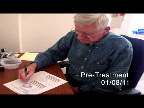 how to control essential tremor