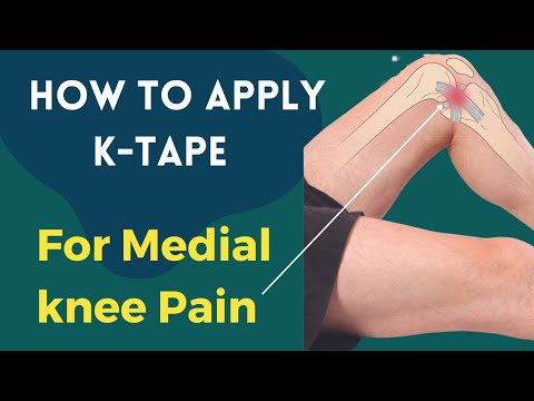 how to treat knee sprain