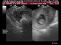 Nosso beb� - Polyana e Edmar