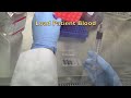 Circulating Tumor Cells