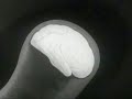 video for the tune 