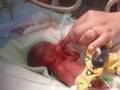 Hunter & Darcy 22 week premature twins