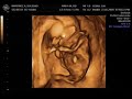 Ecografia de Camila a las 16 semanas