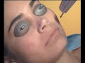See video