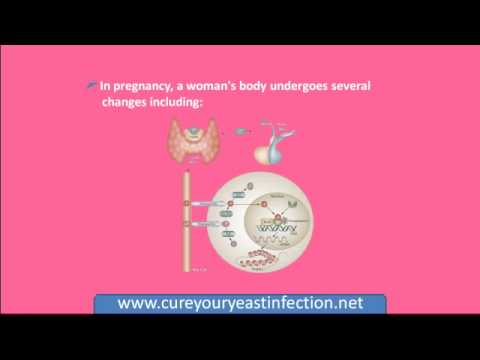 how to cure yeast infection while pregnant