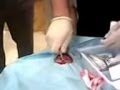 videos de Axe-hole in my leg - Take 3