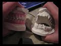 Jaws - Singing dental cast models