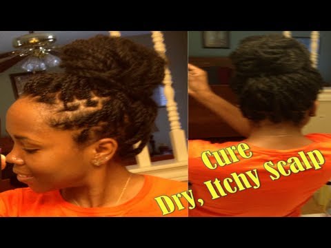 how to help itchy scalp