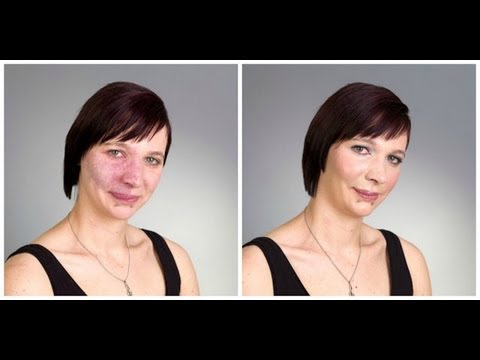 HOW TO: COVER BIRTHMARK - ACNE - SCARS - VITILIGO - TATTOO