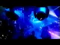 Treekillaz - Do It Again