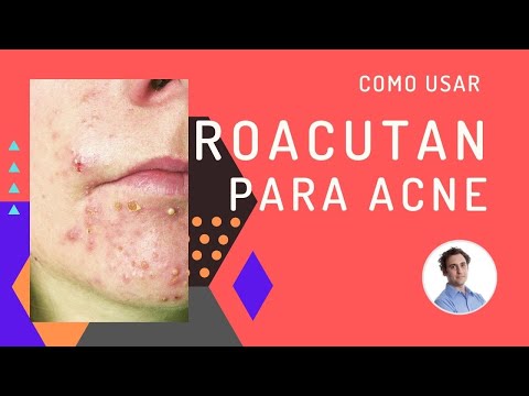 Como usar isotretinoina e roacutan para acne e espinhas