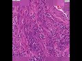 Shotgun Histology Uterus Shotgun Histology Uterus
