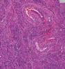 Shotgun Histology Uterus
