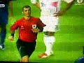 cabesazo pelao zizu
