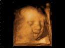 Window to the womb 4d baby scan of krystyna and james Window to the womb 4d baby scan of krystyna and james