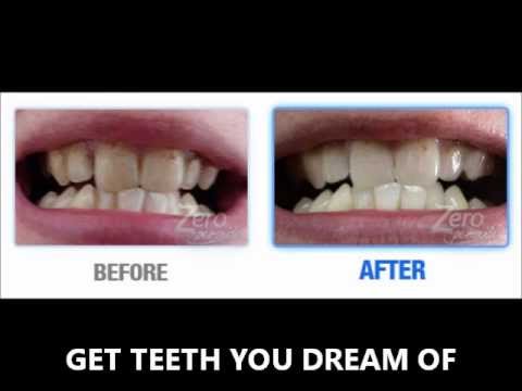 how to whiten teeth while pregnant