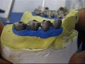 Escultura Dental