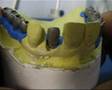 Escultura Dental