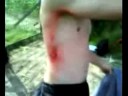Kalkputte: Funny Diving from a Tree