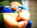 Sugar Gliders as Pets : Giving Medication to Pet Sugar Gliders