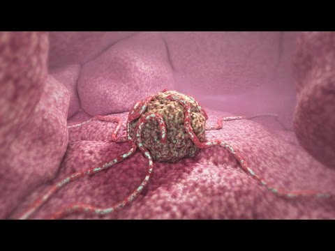 360° Tumor Death Animation (demo) - YouTube