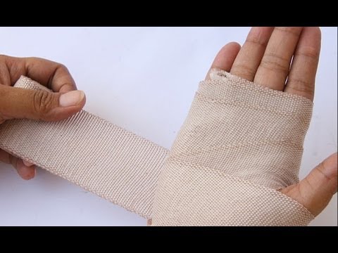 how to treat burn on hand