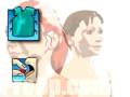 preop® Patient Education Myringotomy Insertion of Tube 2