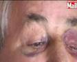 Have-a-go OAP beaten by gang