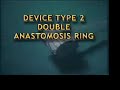 Clinical Case Aorta Substitution by Expandable Prosthesis Clinical Case Aorta Substitution by Expandable Prosthesis
