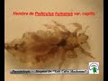 Piojo de la cabeza