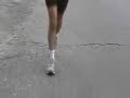 This is me running on 5/11/08, 9 days after botox shots for foot dystonia.  Young-onset Parkinson's Disease is the underlying condition.