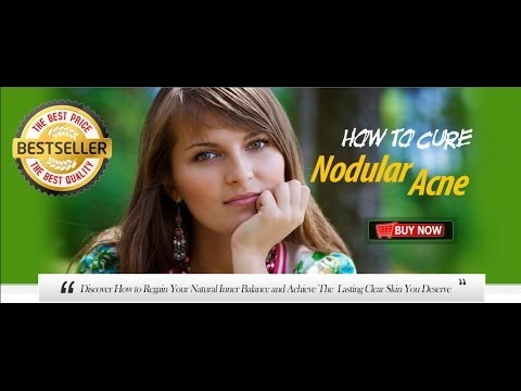how to cure nodules