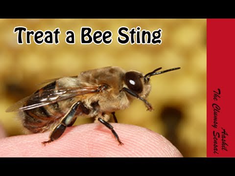 how to relieve bee sting