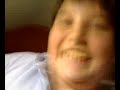 obeso histerico