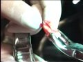 metanfetamina y sus dientes Crystal Meth:The Wrong Road pt 4 metanfetamina y sus dientes Crystal Meth:The Wrong Road pt 4