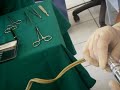 cirugia de reborde alveolar cirugia de reborde alveolar
