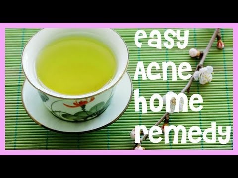 how to treat acne by home remedies