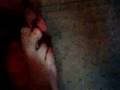 Foot, Feet, webbed toes and bunions