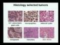 Molecular Profiling Diagnostics for Breast Cancer
