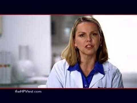how to treat warts with compound w