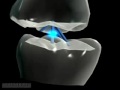 Occlusion dentaire dynamique maxillaire Vidéo 3D Video by drMeemo