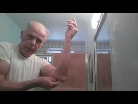 how to drain bursitis