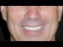 LVI Smile Cosmetic Dentists 1b
