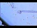TESE (Testicular Sperm Extraction-testicular biopsy)