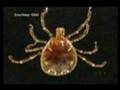 Canadians first to illustrate Lyme disease bacterium