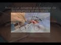 tap-n-nasal-de-hidrocoloide-.html