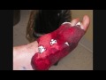bunion surgery.... one of the biggest