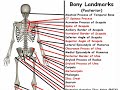 Posterior Bone Landmarks