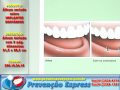 Álbum Seriado IMPLANTES DENTÁRIOS é excelente para explicar benefícios e os tipos de implantes. Orienta os pacientes demosntrando os procedimentos com ilustrações grandes. Aborda: -QUEM É UM BOM CANDIDATO? - SUBSTITUINDO UM ÚNICO DENTE - SUBSTITUINDO VÁRIOS DENTES AUSENTES - PROTESE TOTAL SUPORTADA POR IMPLANTE - CONSTRUINDO OSSO - CUIDANDO DO SEU IMPLANTE NOVO Este Álbum seriado contém 8 páginas nas dimensões: 21,5 x 28,5 cm.