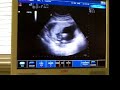video bebe Berdejo Urdaneta